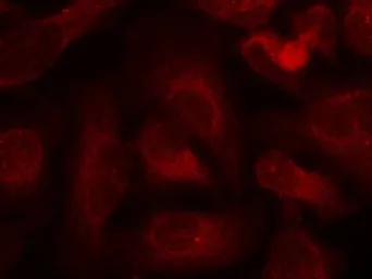 Anti-c-Abl (phospho Tyr412) antibody used in Immunocytochemistry/ Immunofluorescence (ICC/IF). GTX50859