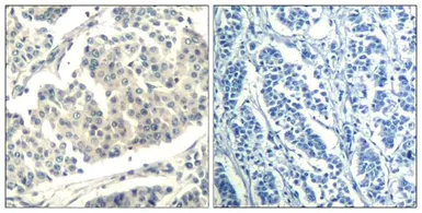 Anti-c-Abl (phospho Tyr412) antibody used in IHC (Paraffin sections) (IHC-P). GTX50859