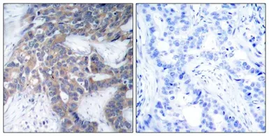Anti-MEK1/MEK2 (phospho Ser218/Ser222) antibody used in IHC (Paraffin sections) (IHC-P). GTX50860