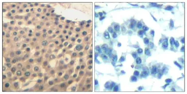Anti-HDAC4/HDAC5/HDAC9 antibody used in IHC (Paraffin sections) (IHC-P). GTX50861