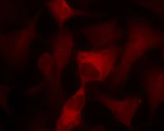 Anti-AMPK alpha 1 + AMPK alpha 2 antibody used in Immunocytochemistry/ Immunofluorescence (ICC/IF). GTX50863
