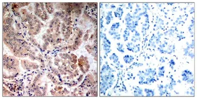 Anti-AMPK alpha 1 + AMPK alpha 2 antibody used in IHC (Paraffin sections) (IHC-P). GTX50863