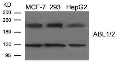 Anti-ABL antibody used in Western Blot (WB). GTX50864