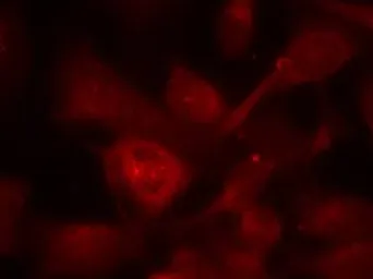 Anti-PAK1/PAK2/PAK3 antibody used in Immunocytochemistry/ Immunofluorescence (ICC/IF). GTX50865