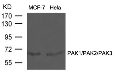 Anti-PAK1/PAK2/PAK3 antibody used in Western Blot (WB). GTX50865
