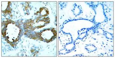 Anti-PAK1 ( phospho Thr423 ) / PAK2 ( phospho Thr402 ) / PAK3 ( phospho Thr436 ) antibody used in IHC (Paraffin sections) (IHC-P). GTX50867