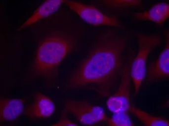 Anti-JNK (phospho Thr183/Tyr185) antibody used in Immunocytochemistry/ Immunofluorescence (ICC/IF). GTX50868
