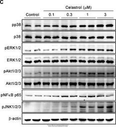 Anti-JNK (phospho Thr183/Tyr185) antibody used in Western Blot (WB). GTX50868