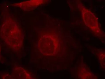 Anti-AKT (phospho Tyr315) antibody used in Immunocytochemistry/ Immunofluorescence (ICC/IF). GTX50869