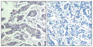 Anti-AKT (phospho Tyr315) antibody used in IHC (Paraffin sections) (IHC-P). GTX50869