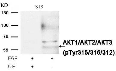 Anti-AKT (phospho Tyr315) antibody used in Western Blot (WB). GTX50869