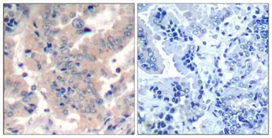 Anti-PI3 kinase p85 / p55 antibody used in IHC (Paraffin sections) (IHC-P). GTX50873
