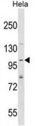 Anti-SH3PXD2A antibody, N-term used in Western Blot (WB). GTX50879