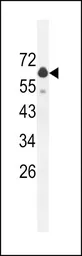 Anti-GLS2 antibody used in Western Blot (WB). GTX50889