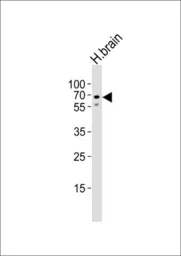 Anti-GLS2 antibody used in Western Blot (WB). GTX50889