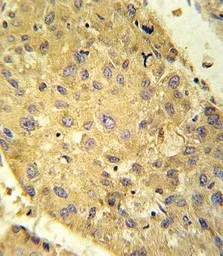 Anti-GLS2 antibody used in IHC (Paraffin sections) (IHC-P). GTX50889