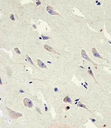 Anti-GLS2 antibody used in IHC (Paraffin sections) (IHC-P). GTX50889