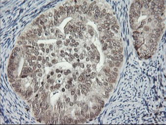 Anti-MCTS1 antibody [2G2] used in IHC (Paraffin sections) (IHC-P). GTX50967