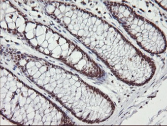 Anti-MCTS1 antibody [2G2] used in IHC (Paraffin sections) (IHC-P). GTX50967