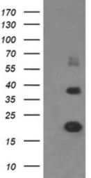 Anti-MCTS1 antibody [2G2] used in Western Blot (WB). GTX50967