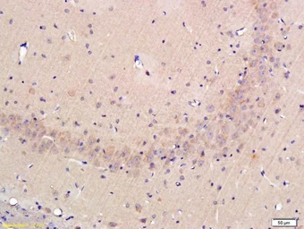 Anti-Osteopontin antibody used in IHC (Paraffin sections) (IHC-P). GTX50974