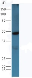Anti-Osteopontin antibody used in Western Blot (WB). GTX50974