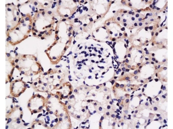 Anti-FGL2 antibody used in IHC (Paraffin sections) (IHC-P). GTX50977