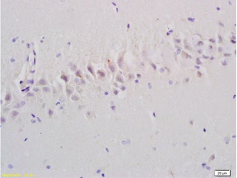 Anti-Emp1 antibody used in IHC (Paraffin sections) (IHC-P). GTX50979