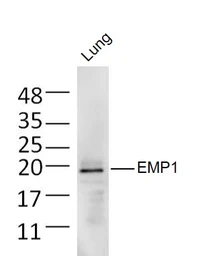 Anti-Emp1 antibody used in Western Blot (WB). GTX50979