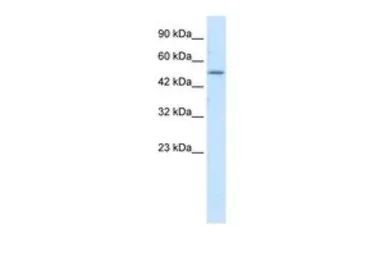Anti-ZNF683 antibody, N-term used in Western Blot (WB). GTX50980