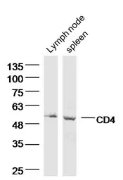 Anti-CD4 antibody used in Western Blot (WB). GTX50984