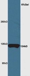 Anti-MRF antibody used in Western Blot (WB). GTX51055