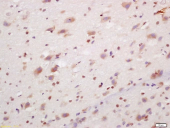 Anti-PCP4 antibody used in IHC (Paraffin sections) (IHC-P). GTX51070
