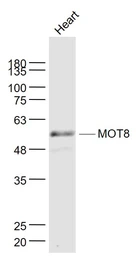 Anti-MCT8 antibody used in Western Blot (WB). GTX51095