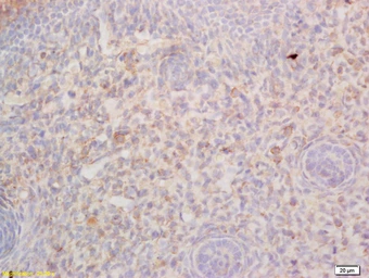 Anti-RGMA antibody used in IHC (Paraffin sections) (IHC-P). GTX51106