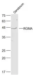 Anti-RGMA antibody used in Western Blot (WB). GTX51106