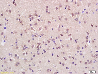Anti-ASH1L antibody used in IHC (Paraffin sections) (IHC-P). GTX51191
