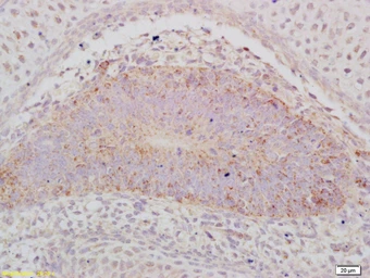 Anti-ABCA12 antibody used in IHC (Paraffin sections) (IHC-P). GTX51202