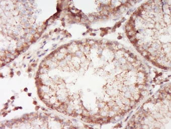 Anti-ABCA12 antibody used in IHC (Paraffin sections) (IHC-P). GTX51202
