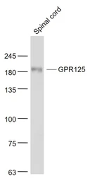 Anti-GPR125 antibody used in Western Blot (WB). GTX51219