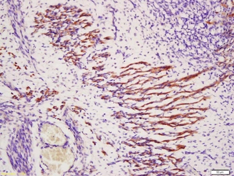 Anti-TXLNB antibody used in IHC (Paraffin sections) (IHC-P). GTX51247