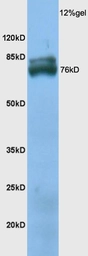 Anti-TXLNB antibody used in Western Blot (WB). GTX51247