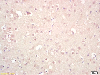 Anti-GGNBP2 antibody used in IHC (Paraffin sections) (IHC-P). GTX51277