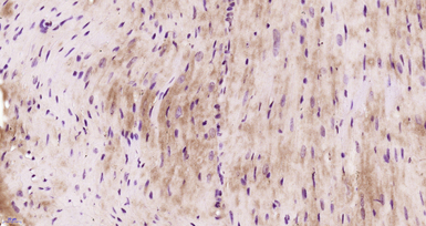 Anti-FLNC antibody used in IHC (Paraffin sections) (IHC-P). GTX51350