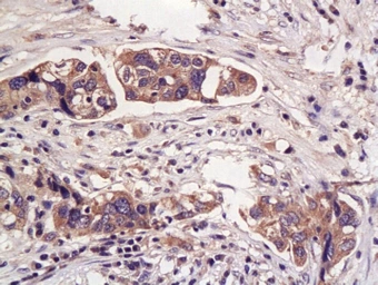 Anti-Haptoglobin antibody used in IHC (Paraffin sections) (IHC-P). GTX51524