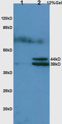 Anti-Haptoglobin antibody used in Western Blot (WB). GTX51524
