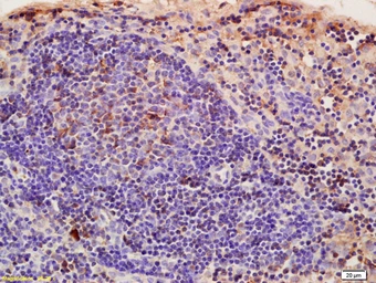 Anti-CRIM1 antibody used in IHC (Paraffin sections) (IHC-P). GTX51530