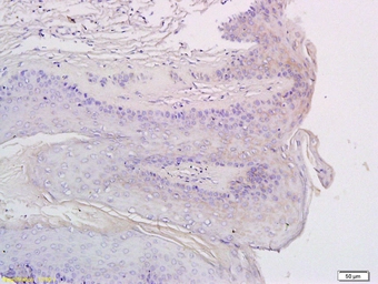 Anti-CXCR3 antibody used in IHC (Paraffin sections) (IHC-P). GTX51532