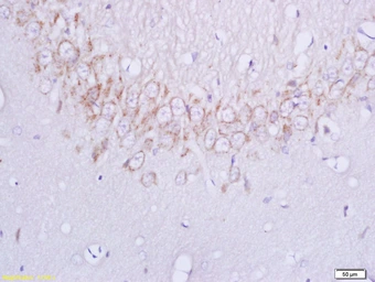 Anti-Plexin B1 antibody used in IHC (Paraffin sections) (IHC-P). GTX51549
