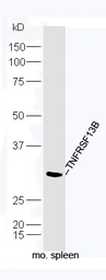 Anti-TACI antibody used in Western Blot (WB). GTX51554